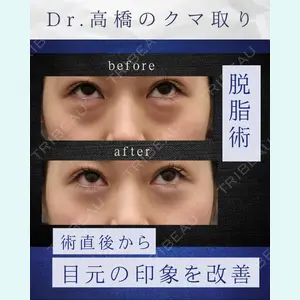 症例