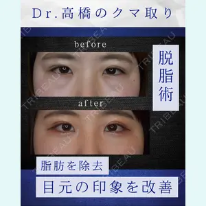 症例