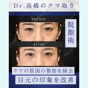 症例