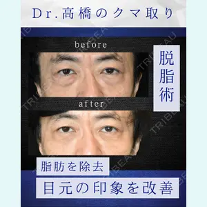 症例