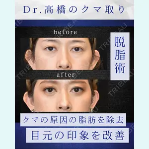 症例