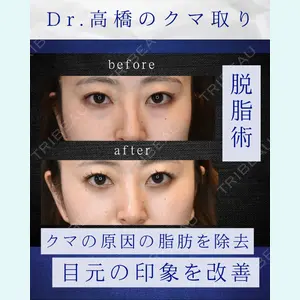 症例