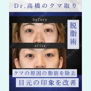 症例