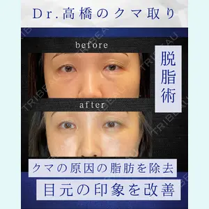 症例