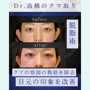症例