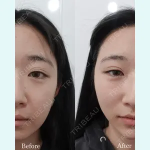 L‘amour clinic Tokyo【ラムールクリニック東京】の症例