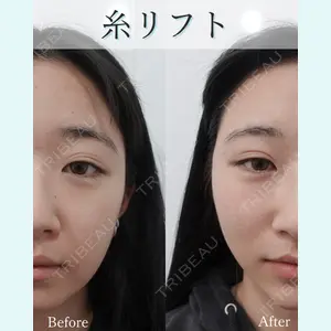L‘amour clinic Tokyo【ラムールクリニック東京】の症例