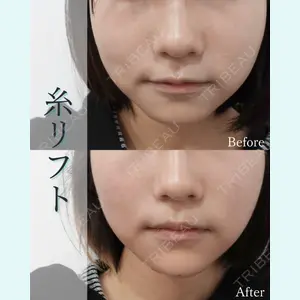L‘amour clinic Tokyo【ラムールクリニック東京】の症例