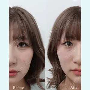 L‘amour clinic Tokyo【ラムールクリニック東京】の症例