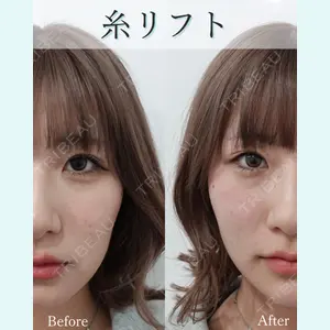 L‘amour clinic Tokyo【ラムールクリニック東京】の症例