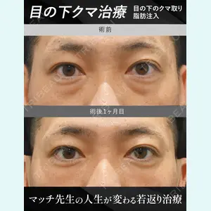 症例