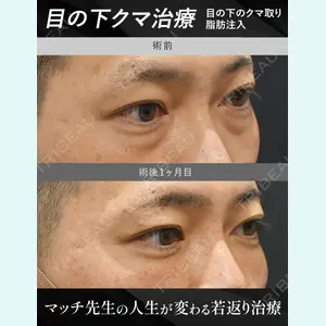 症例