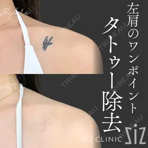 症例