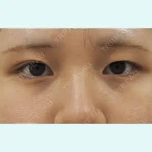 下北沢スキンクリニック 保坂 宗孝医師の症例