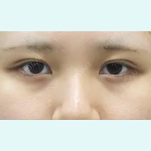 下北沢スキンクリニック 保坂 宗孝医師の症例
