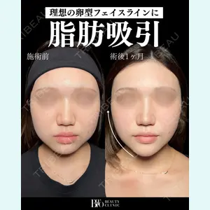 BITO BEAUTY CLINIC 伊藤 富良野医師の症例