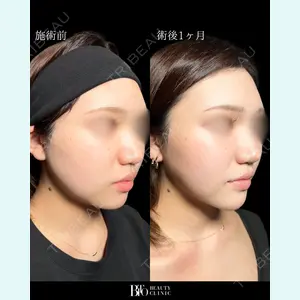 BITO BEAUTY CLINIC 伊藤 富良野医師の症例