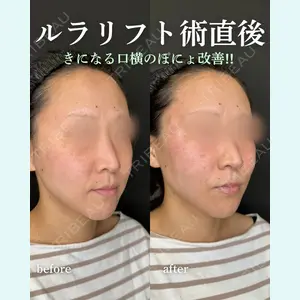 ルラ美容クリニック 岐阜院 馬場 愛理医師の症例