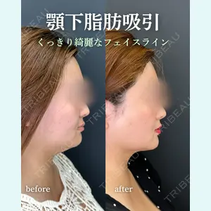 ルラ美容クリニック 岐阜院 馬場 愛理医師の症例