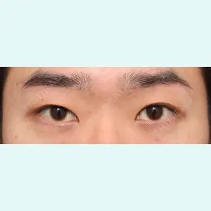 プリモ麻布十番クリニック 大場教弘医師の症例