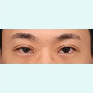 プリモ麻布十番クリニック 大場教弘医師の症例