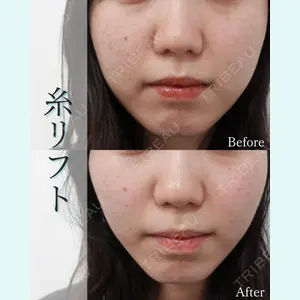 L‘amour clinic Tokyo【ラムールクリニック東京】の症例