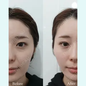 L‘amour clinic Tokyo【ラムールクリニック東京】の症例