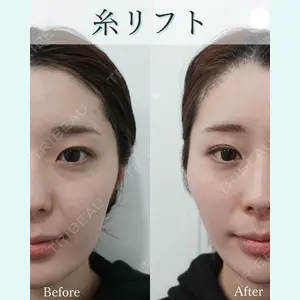 L‘amour clinic Tokyo【ラムールクリニック東京】の症例