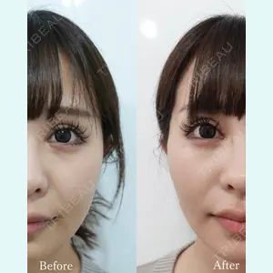 L‘amour clinic Tokyo【ラムールクリニック東京】の症例
