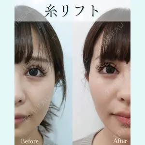 L‘amour clinic Tokyo【ラムールクリニック東京】の症例