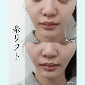L‘amour clinic Tokyo【ラムールクリニック東京】の症例