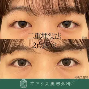 オアシス美容外科 遠藤 剛史医師の症例