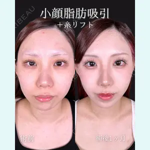東京シンデレラ美容外科 池袋院 石井 達也医師の症例