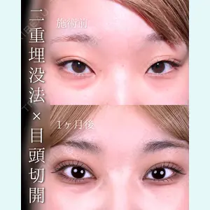 東京シンデレラ美容外科 池袋院 石井 達也医師の症例