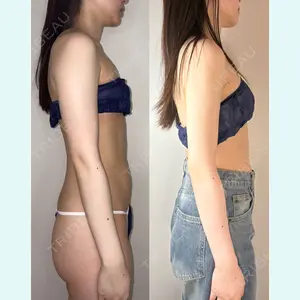 GAYA body design clinic 飯ヶ谷 重来医師の症例