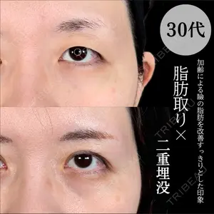 症例