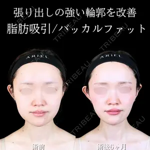 症例