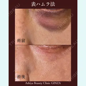 症例