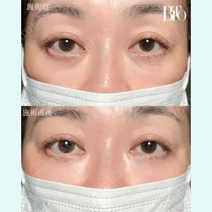 BITO BEAUTY CLINIC 伊藤 富良野医師の症例