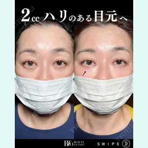 BITO BEAUTY CLINIC 伊藤 富良野医師の症例