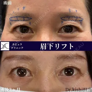 症例