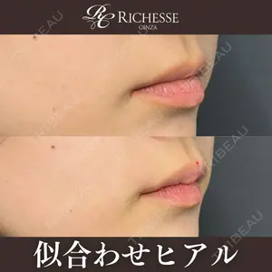 症例