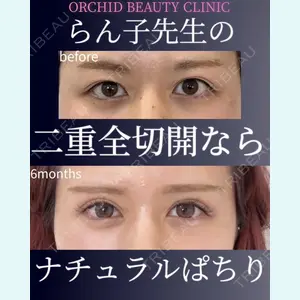 症例