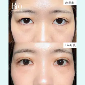 BITO BEAUTY CLINIC 伊藤 富良野医師の症例