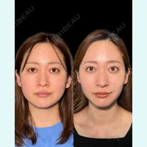 PRISM Beauty Clinicの症例