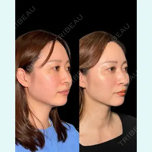 PRISM Beauty Clinicの症例