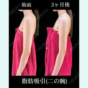 症例