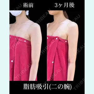症例