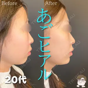 症例