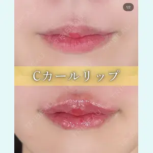 ルラ美容クリニック 京都院 矢田 玲奈医師の症例